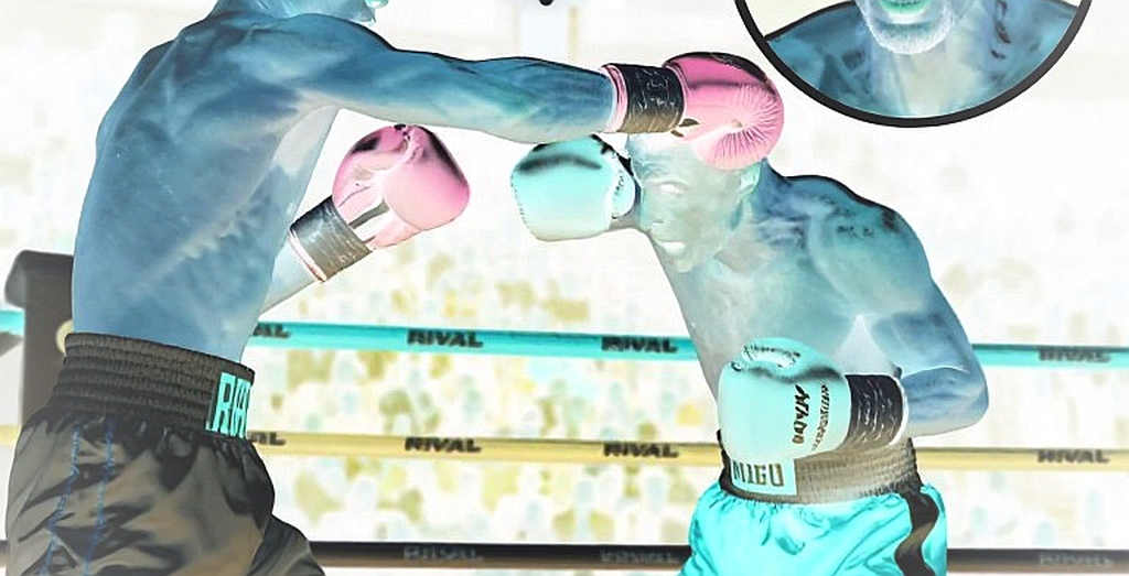 किलो बदले, तमग़े नहीं: भारतीय मुक्केबाज़ी का असली ट्रांसफ़र विंडो क्लर्क की मेज़ पर बंद होता है